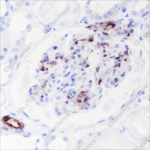 Recombinant Complement C4-B Monoclonal Antibody - 2