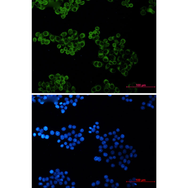 Recombinant BID Monoclonal Antibody - 3