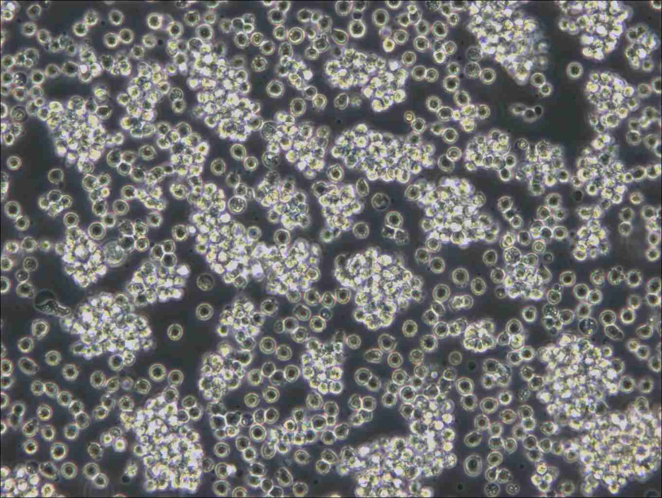 WSU-DLCL2 Cell Complete Medium - small - 5