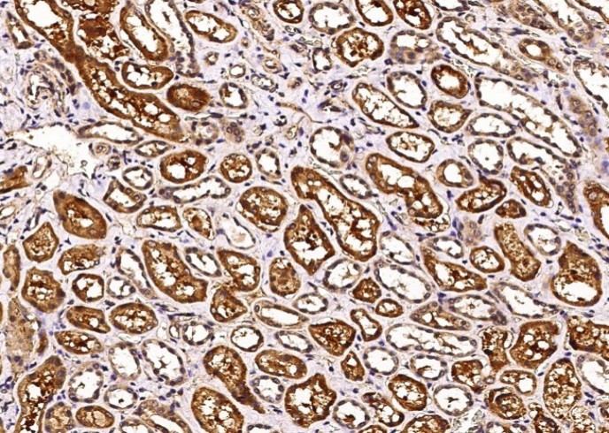 Recombinant Carbonic Anhydrase VB/CA5B Monoclonal Antibody - small - 3