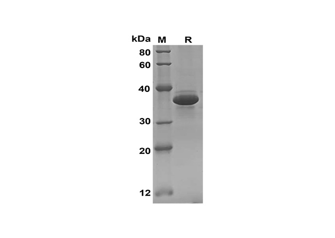 Recombinant Human CNTF Protein(Gst Tag)-产品推荐-1