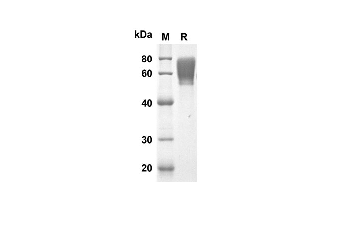 Recombinant Rat CD48 Protein(Fc Tag)-1