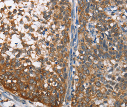MAD2L1BP Polyclonal Antibody - 2