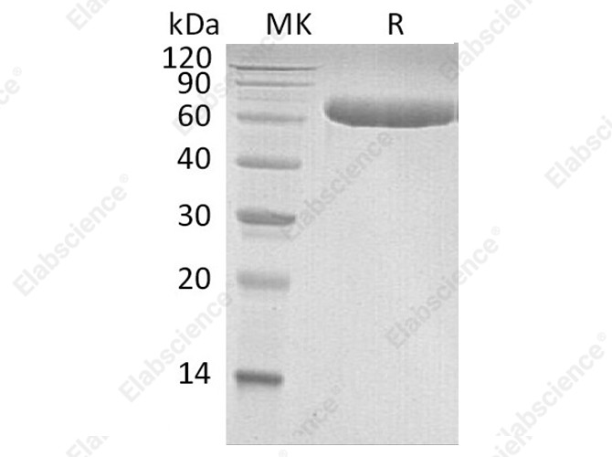 Recombinant Human LBP Protein (His Tag) - 1