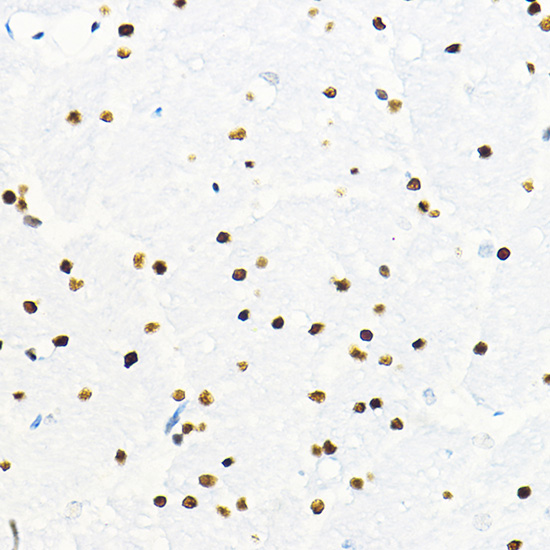 Immunohistochemistry of paraffin-embedded mouse brain using ZEB2 Polyclonal antibody at dilution of 1:100 (40x lens).Perform high pressure antigen retrieval with 10 mM citrate buffer pH 6.0 before commencing with IHC staining protocol.