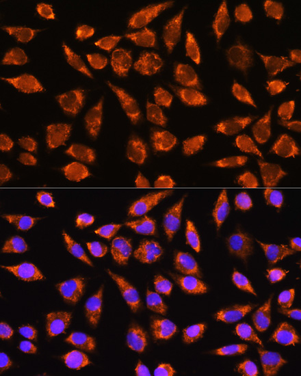 Immunofluorescence analysis of L929 cells using MARK2 Polyclonal Antibody at dilution of  1:100. Blue: DAPI for nuclear staining.