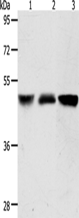 Western Blot analysis of Human brain malignant glioma and Human fetal kidney tissue, A172 cell using ACOT9 Polyclonal Antibody at dilution of 1:600