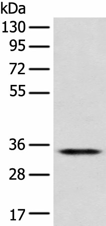 Western blot analysis of Jurkat cell  using CD1D Polyclonal Antibody at dilution of 1:300