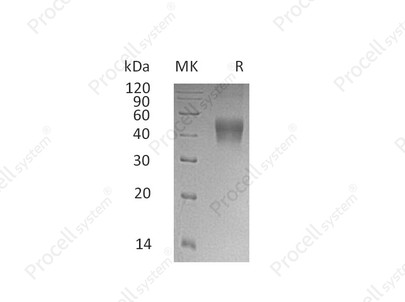 IL-21R/CD360, Human, Recombinant