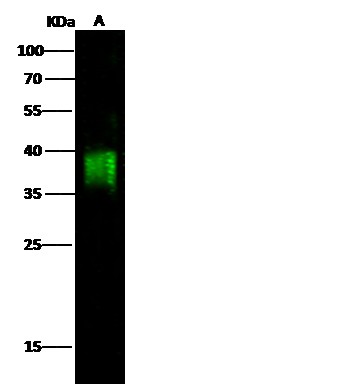 Recombinant CD84/SLAMF5 Monoclonal Antibody - small - 2