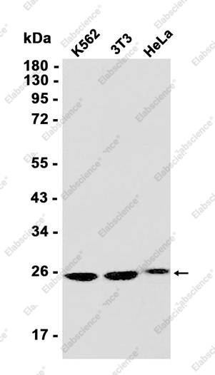 Recombinant Securin Monoclonal Antibody - 1