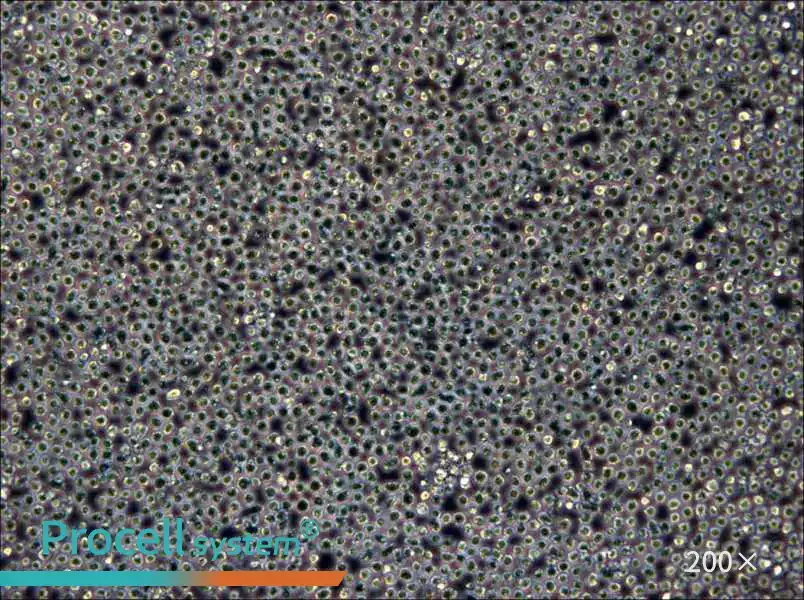 Z-138 Cell Complete Medium - 4