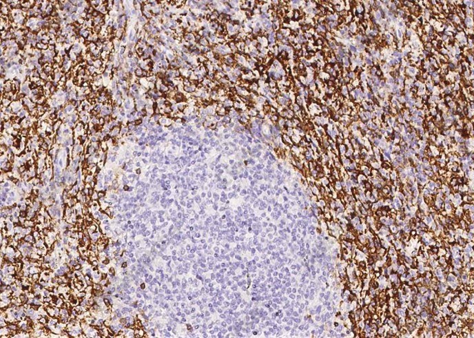 CD16b/FCGR3B Monoclonal Antibody - 2