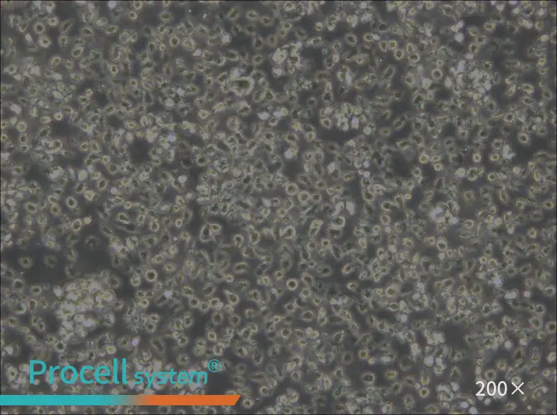 MEC-1 Cell Complete Medium - 6