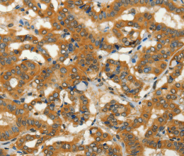 ADCY3 Polyclonal Antibody - 3