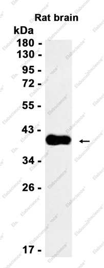 Recombinant HuD/HuC Monoclonal Antibody - 1