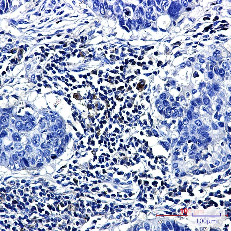Recombinant Prostaglandin D Synthase Monoclonal Antibody - 3