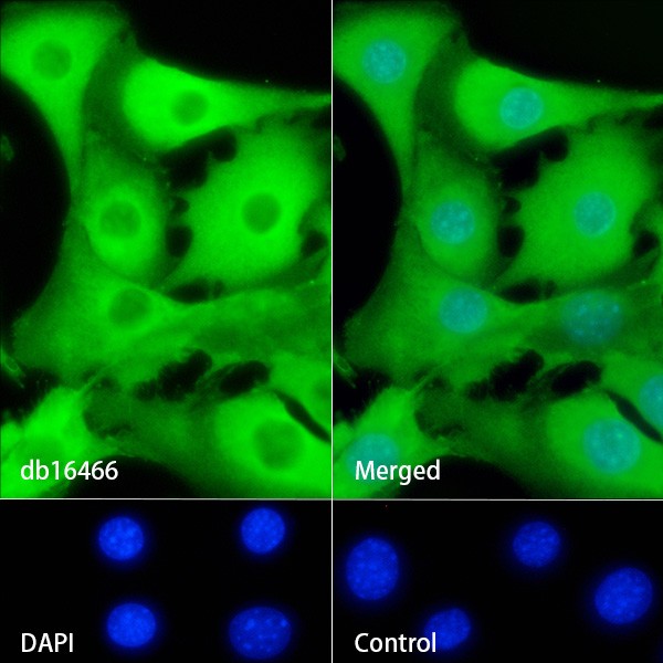 Recombinant S100A6/Calcyclin/CACY Monoclonal Antibody - 2