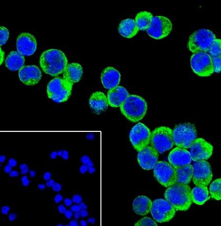 Recombinant SHIP-1 Monoclonal Antibody - small - 4