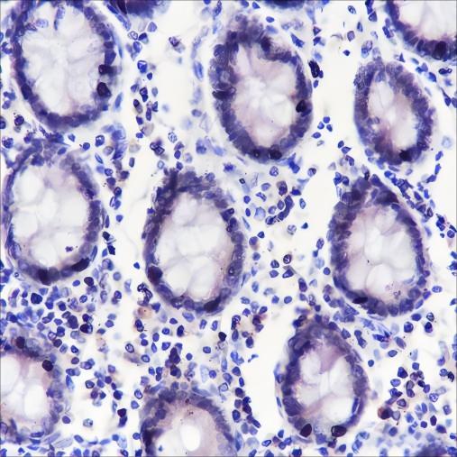 Recombinant ING5 Monoclonal Antibody - 2