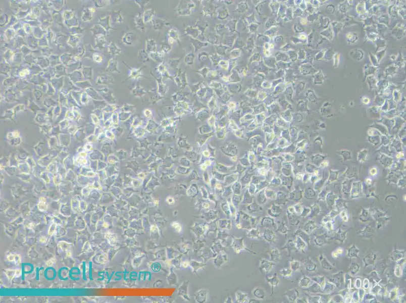 92-1 [Human uveal melanoma] Cell Complete Medium92-1 [Human uveal melanoma] Cell Complete Medium - 2