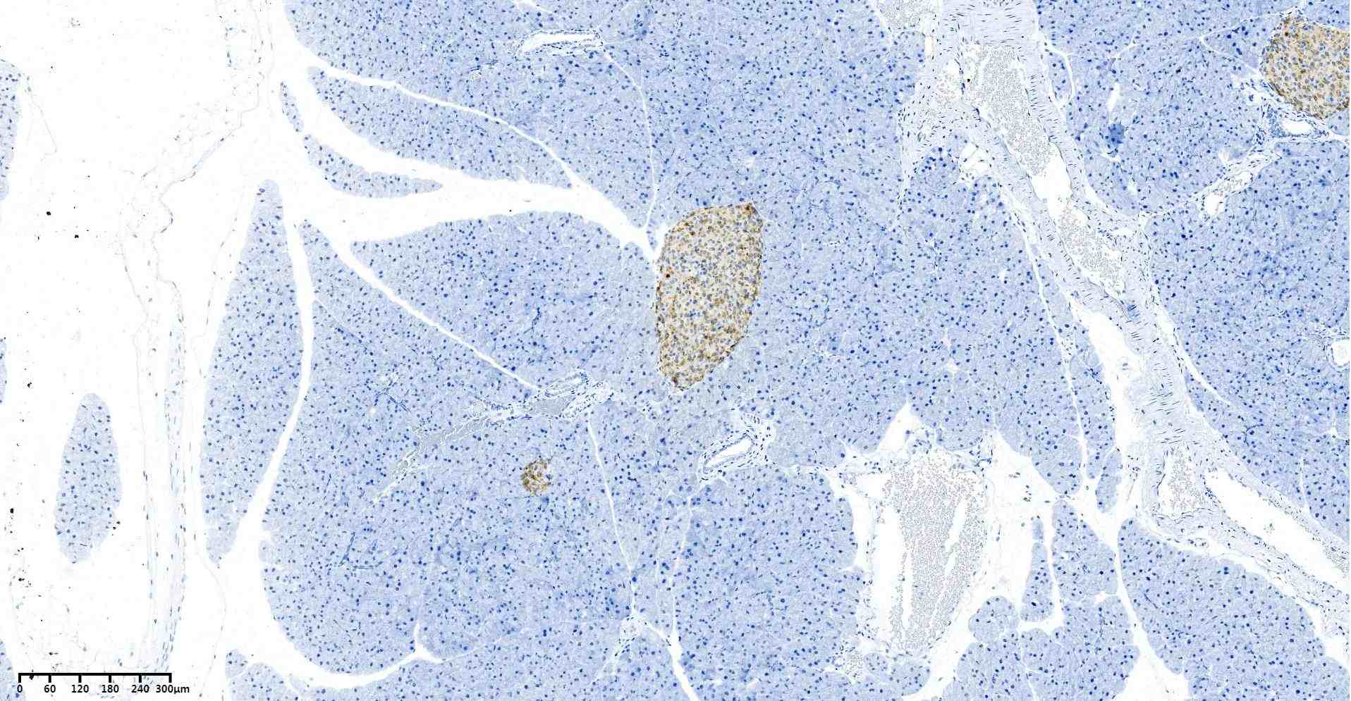 Recombinant Chromogranin A/CHGA/CGA Monoclonal Antibody - small - 6