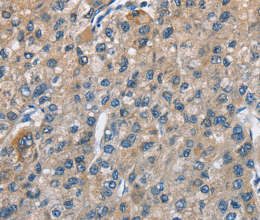 TRIP4 Polyclonal Antibody - 2