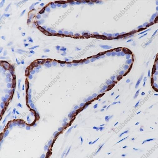 Recombinant Keratin 6 Monoclonal Antibody - 5