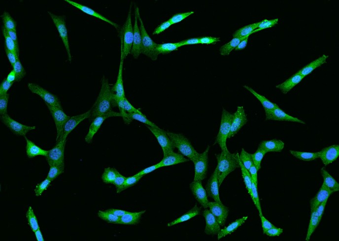 Recombinant MEK1/MAP2K1 Monoclonal Antibody - small - 2