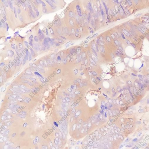 Recombinant ROCK2 Monoclonal Antibody - 3