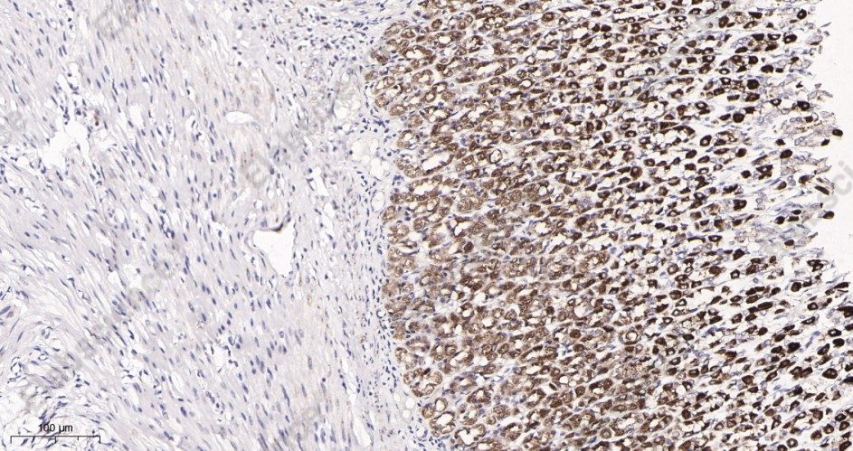 Recombinant IRF3 Monoclonal Antibody - 3