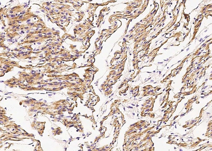 Desmin Monoclonal Antibody-searchlist-1