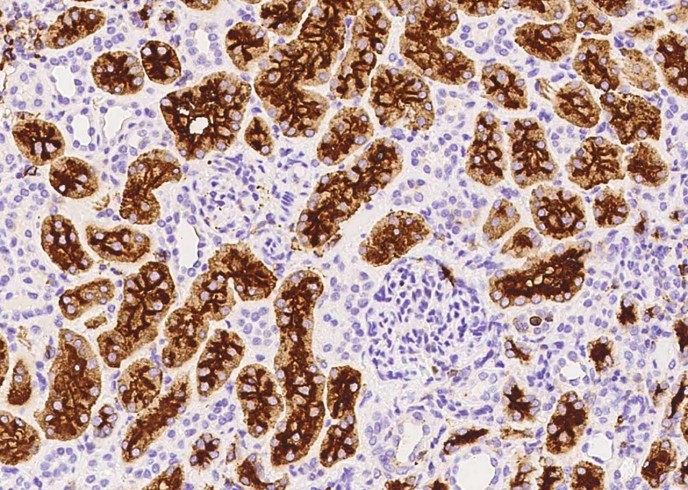 CD13/ANPEP Monoclonal Antibody - small - 2