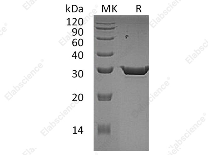 Recombinant Human 15-PGDH Protein (His Tag) - 1