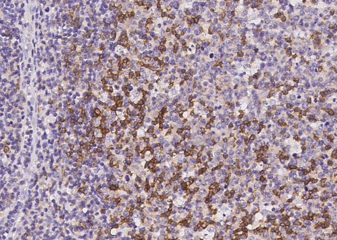PD1/PDCD1/CD279 Monoclonal Antibody-searchlist-1