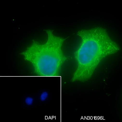 Recombinant IRF6 Monoclonal Antibody - 2