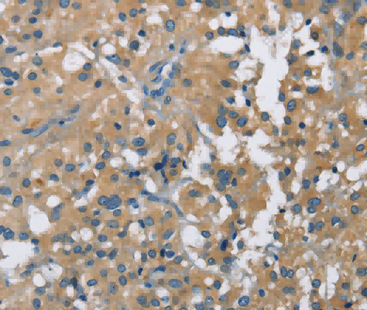 CAB39L Polyclonal Antibody - 2