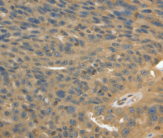 MSN Polyclonal Antibody - 3