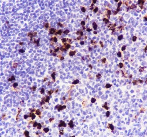 Recombinant Lysozyme Monoclonal Antibody - 3