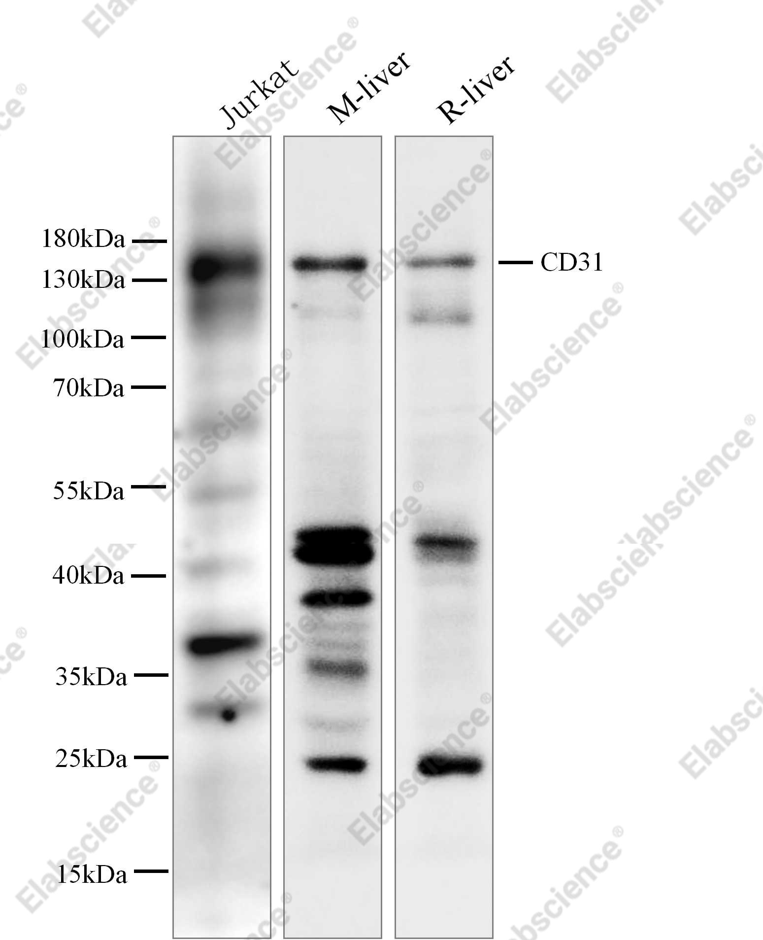 Recombinant CD31 Monoclonal Antibody - 2
