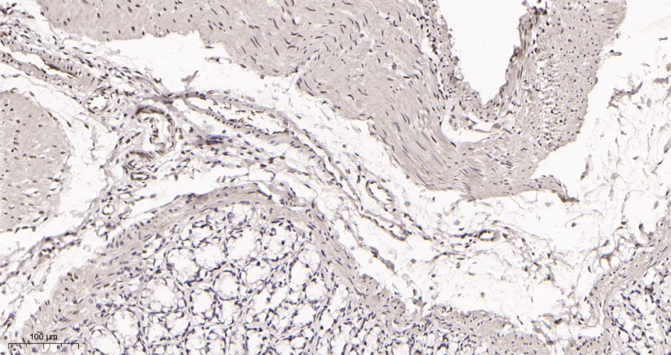 Recombinant AREB6 Monoclonal Antibody - small - 3