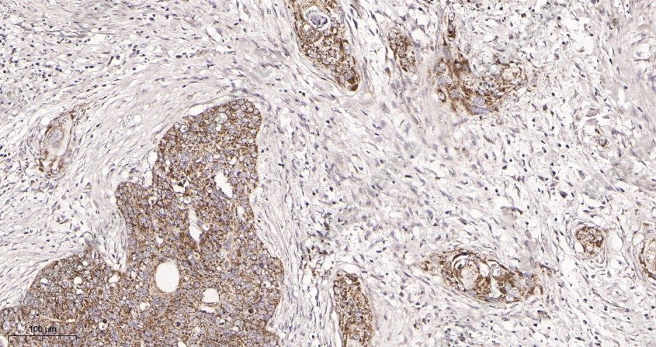 Recombinant TOMM20 Monoclonal Antibody - 2