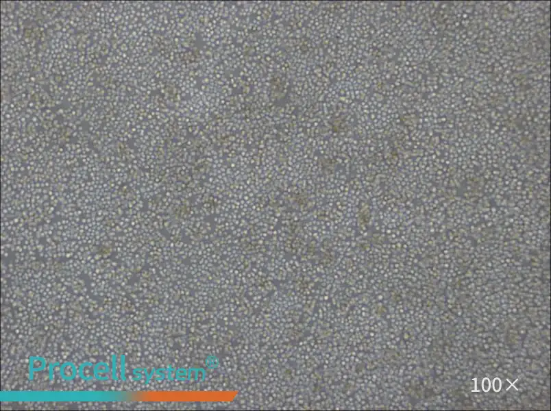 DoHH2 Cell Complete Medium - 1