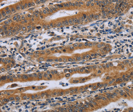 NDUFAF4 Polyclonal Antibody - 3