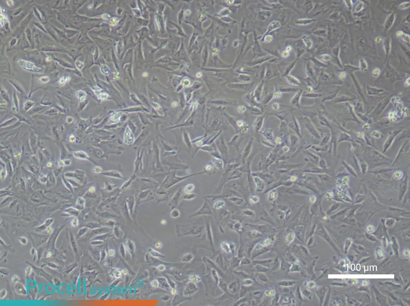 Mouse PreadipocytesMouse Preadipocytes - 2