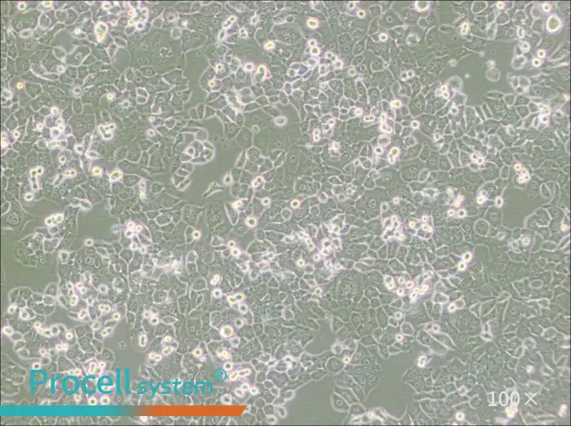 NCI-H2126 Cell Complete Medium - 3