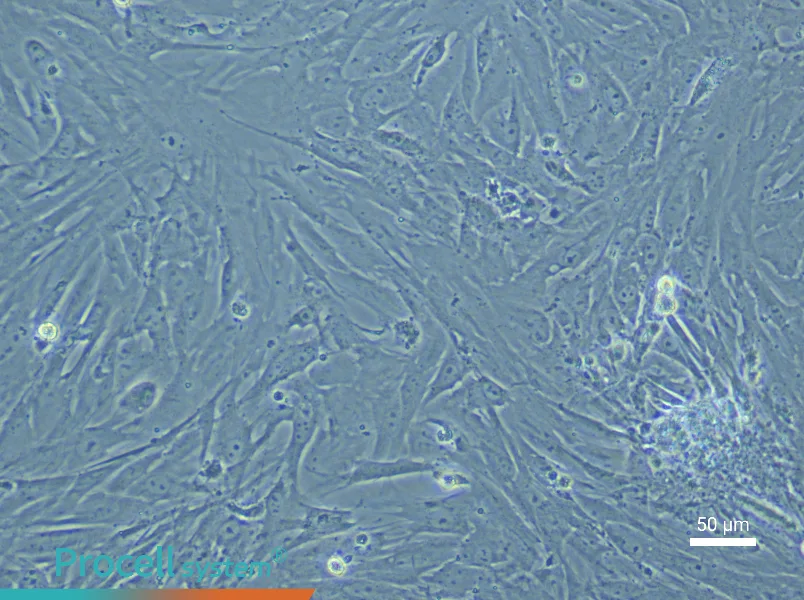 Mouse Uterine Fibroblast Complete Medium - 6