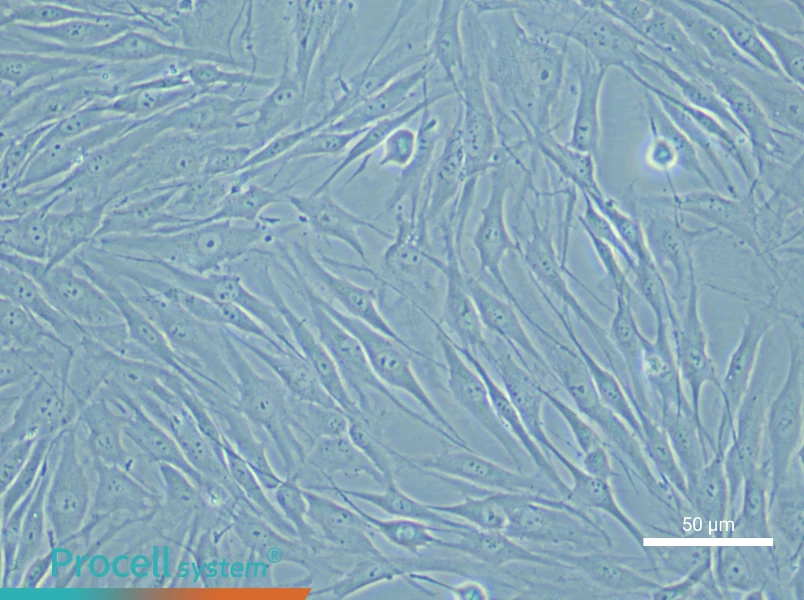 Human Coronary Artery Smooth Muscle Cell Complete Medium - 4