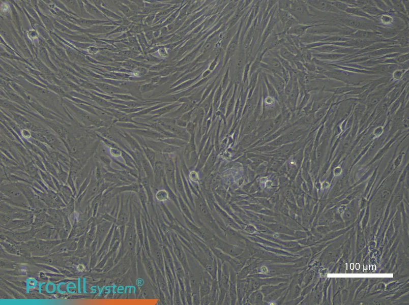 Human Gingival Fibroblast Complete Medium - 3