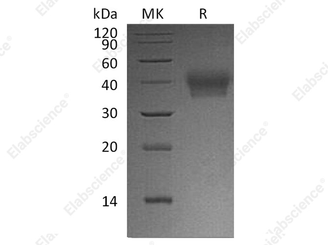 Recombinant Human BTN2A1 Protein (His Tag) - 1